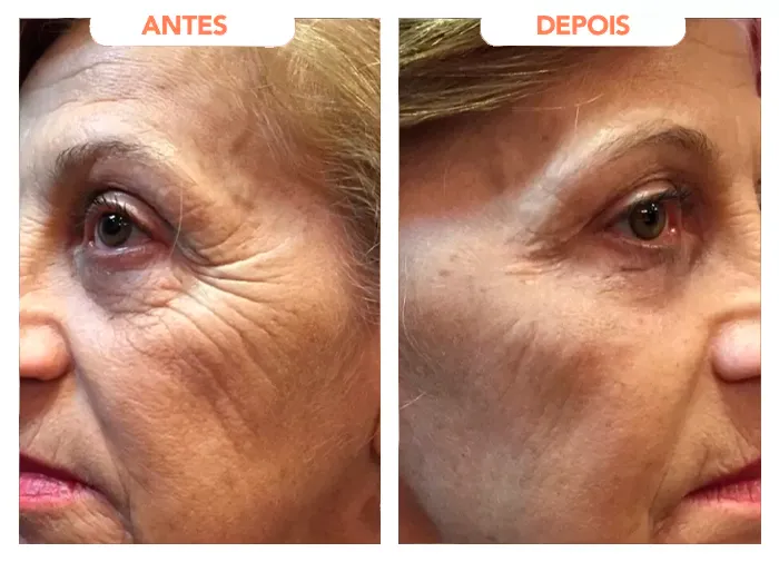 DEPOIMENTO 4