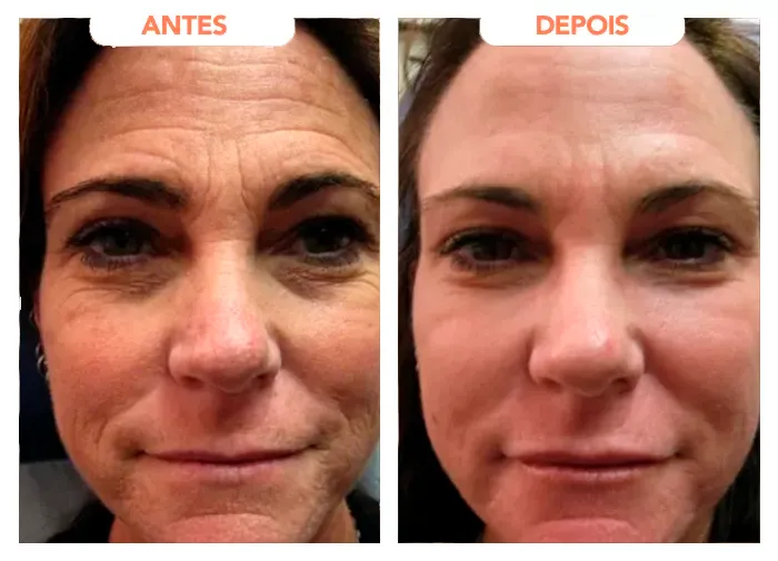 DEPOIMENTO 5